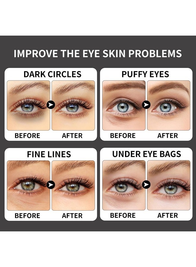 روس رقع الكولاجين تحت العين مع قناع علاج العين بالكافيين للهالات السوداء وتعب العين والانتفاخات المنعشة والمنشطة للعناية بالبشرة وسادات جل العين 20 زوجًا - Image 4