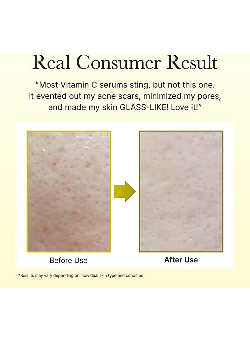 Arencia Vitamin C Booster Shot Cream, Eye Cream with Glutathione, Niacinamide & Vitamin E - Image 3