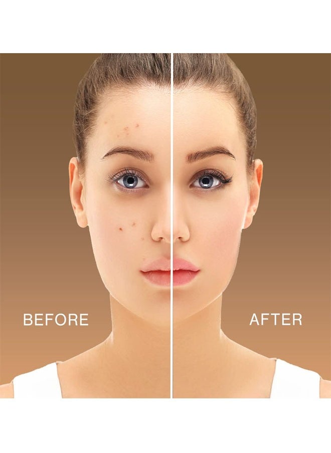 GLAZZI - Pro Conceal HD Concealer, Long-Wearing Formula Neutralizes Dark Spots, Blue Hues, Scars, and Dark Circles, Can Be Used Before Makeup, Perfectly Blends Into Liquid Foundation - Image 1