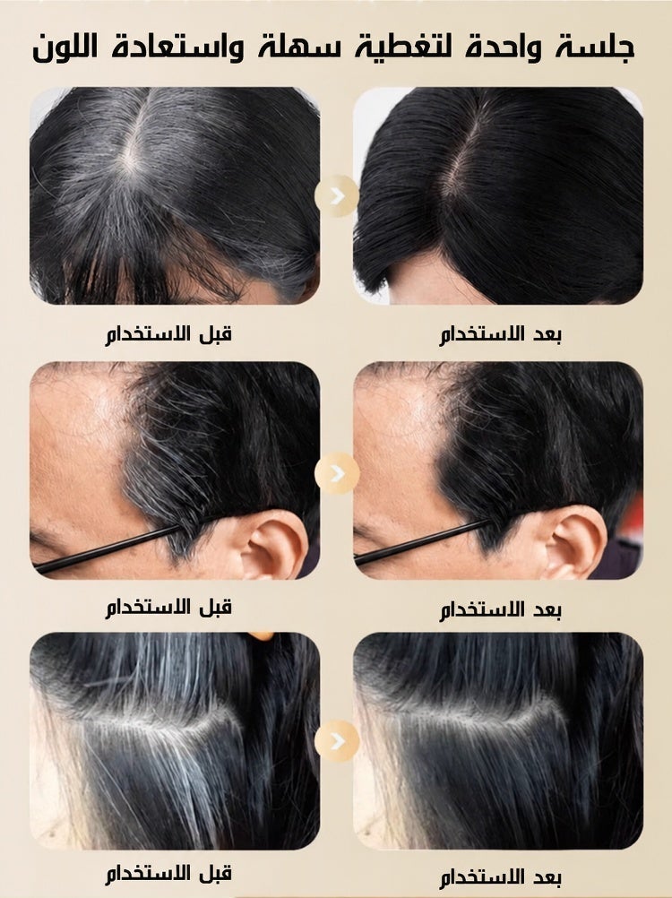 Quick Gray Hair Cover & Long-Lasting Hair Styling Stick for Men & Women - Image 5