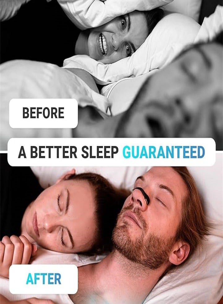 Anti-snoring nose patch / Improve sleep quality / Suitable for hotels / home / business travel (black) - Image 3