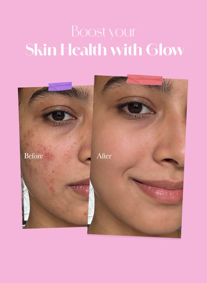 CHICNUTRIX Glow - Japanese Glutathione & Vit. C for skin radiance & even tone - 20 Effervescent Tablets, Strawberry-Lemon flavour - Image 5
