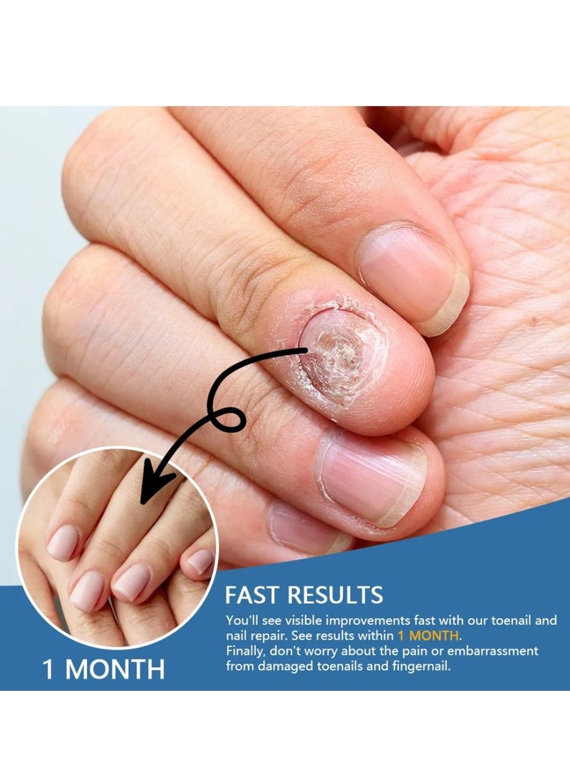 Sumifun بخاخ تخفيف فطريات الأظافر لتجديد الأظافر اليدوية والقدمية، إصلاح مضاد للفطريات، تنعيم وترطيب الأظافر، تغذية واستعادة الأظافر الصحية، بخاخ علاج فطريات الأظافر 30 مل - Image 5