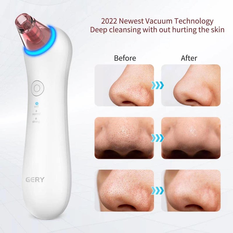 GERY Blackhead Remover Vacuum Pore Extractor Black Head Remover for Face Blackhead Extractor Pore Vacuum Pimple Extractor Skin Tag Remover Tool Pore Cleaner with Red&blue light 3 Modes 4 Suction Heads - Image 2