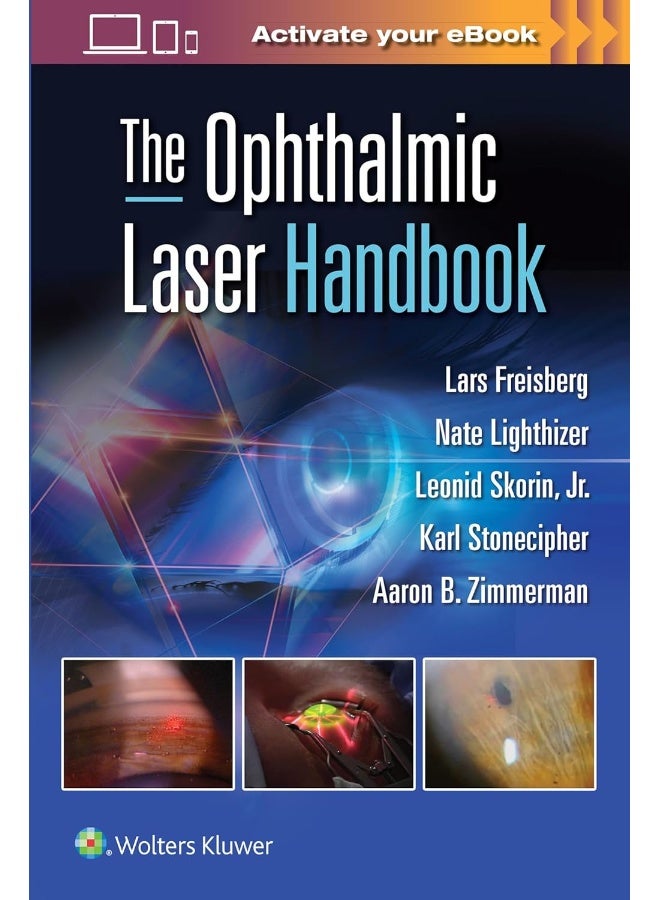 The Ophthalmic Laser Handbook 