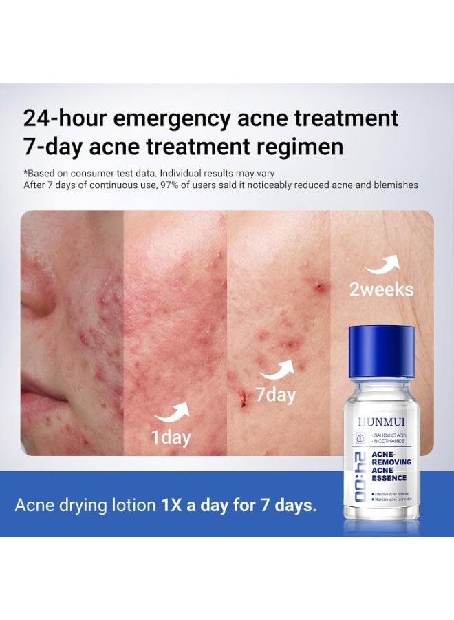 HUNMUI 1.8% Salicylic Acid Acne Serum For Oily, Acne-Prone Skin Rapid-Acting Formula with 4% Niacinamide & Zinc Oxide Unclogs Pores to Combat Night and Hormonal Breakouts, 24h SOS Acne Removing - Image 5
