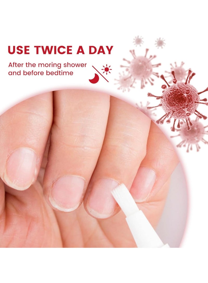 Sumifun Nail Repair Pen 4ml Antifungal Solution for Nail Repair, Targets Discoloration Gray & Black Nails, Antibacterial Pen for Nail Care, Enhances Nail Thickness & Cleanliness, Restores Healthy Nail - Image 3