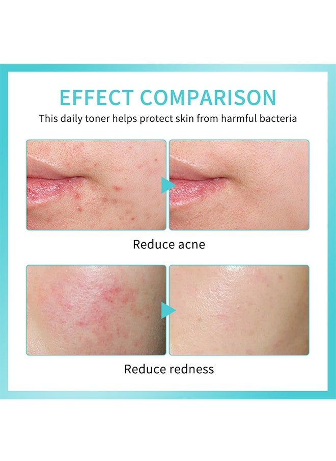lakerain Daily Rescue Facial Spray，Hypochlorous Acid Face and Skin Spray,Facial Toner with Pure Hypochlorous,Moisturising Spray for Sensitive Skin,Acid Hypochlorous Acid Spray 30ml  - Image 3