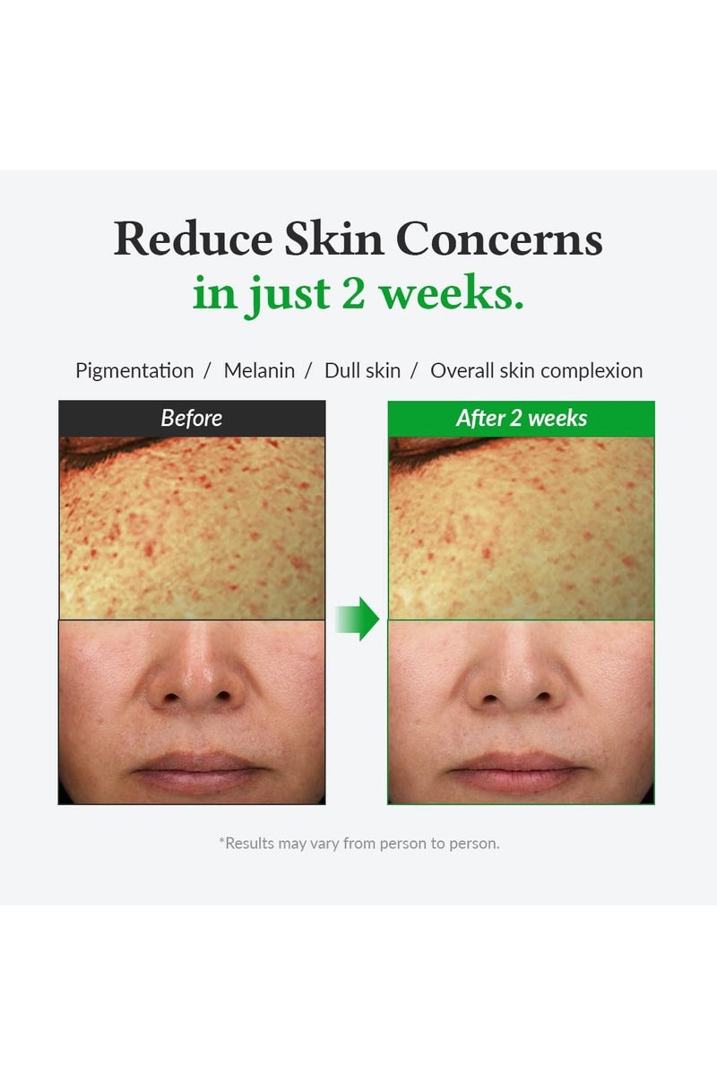 دي آر.ألثيا سيروم فيتامين سي لطيف  فوائد لون الجلد وتصبغته  لطيف على الجلد حتى لون الجلد  العناية بالبشرة النباتية الكورية لجميع أنواع الجلد (فيتامين سي لطيف) - Image 3