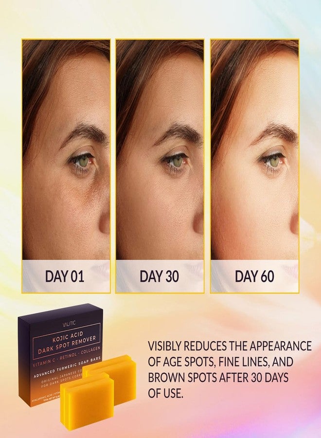 Valitic Kojic Acid Dark Spot Remover Soap Bar with Vitamin C, Retinol, Collagen, Turmeric - Original Japanese Complex - Hyaluronic Acid, Vitamin E, Shea Butter, Castile Oil ( 4 Pack ) With Soap Holder - Image 2