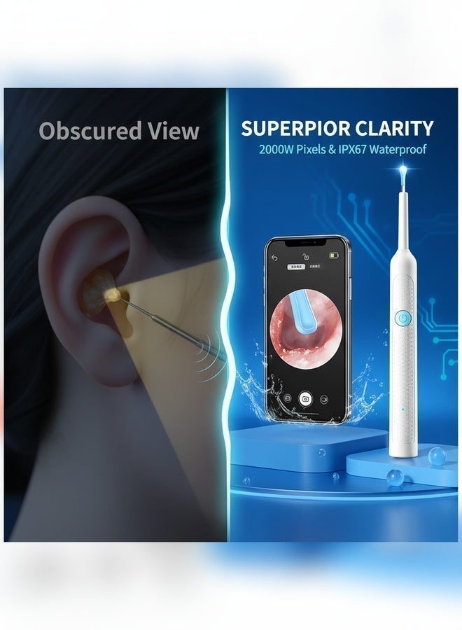 Sthxyfaith Ear Wax Removal - 2000w HD camera with Camera Earwax Remover Tool with 9 Pcs Ear Set - Earwax Removal Kit with Light -With 6 soft silicone ear spoons - Ear Cleaner for iOS & Android - Image 5