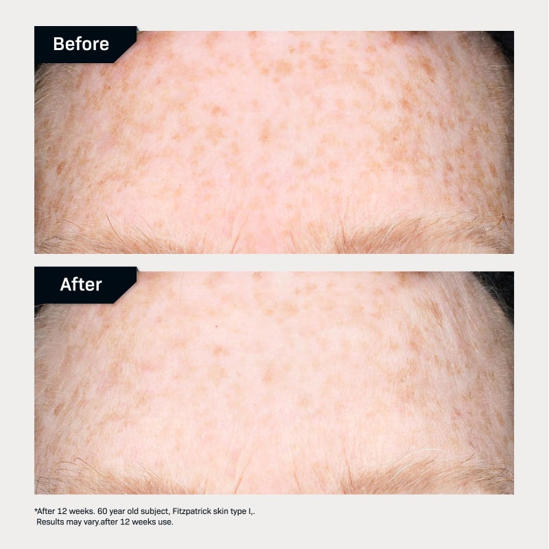 Revision Skincare IntellishadeÂ® TruPhysical Clear SPF 50, 100% Mineral Face Sunscreen, Oil-Free Anti-Aging Moisturizer with SPF and Vitamin C, Invisible Sunscreen for Sensitive Skin, 1.7 oz - Image 5