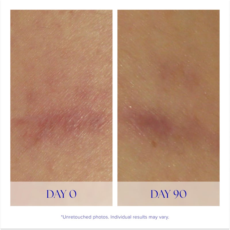 iS CLINICAL Super Serum Advance+, Anti-Aging Vitamin C Face Serum, reduces scaring and fine stretch marks, 0.5 Fl Oz - Image 4