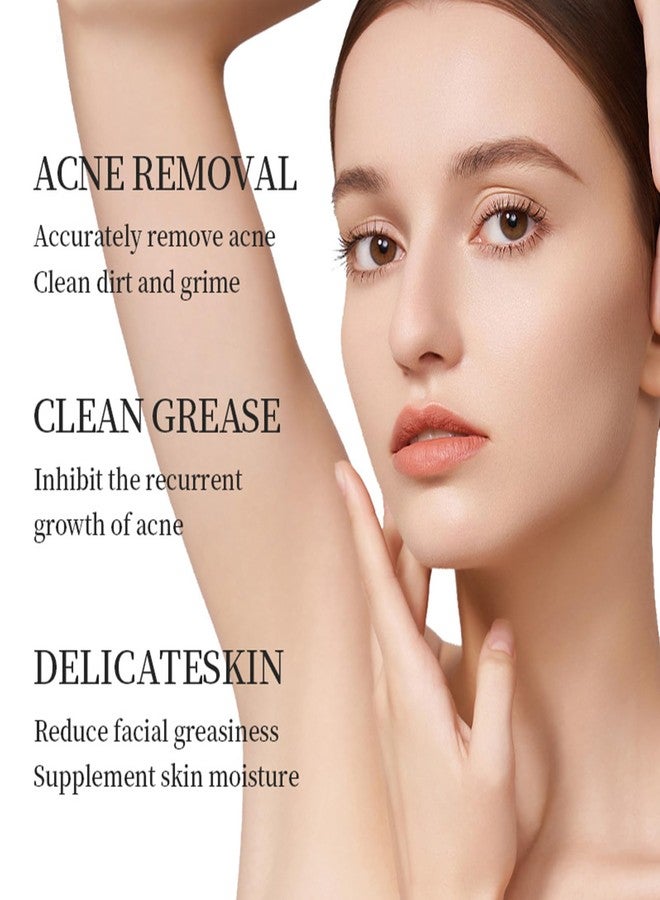 Grospe 14% Azelaic Acid Acne Cream for Face,14% Azelaic Acid With Hyaluronic Acids for Face Redness Smooth, Anti Acne Breakouts Azelaic Acid Serum Balance Excess Oil & Soothing No Irritation - Image 5
