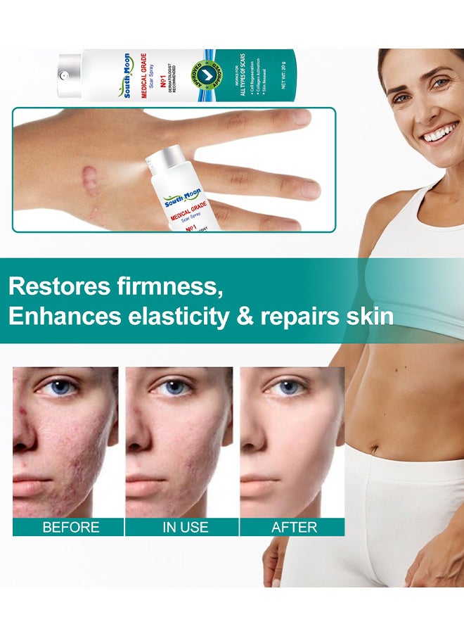 SOUTH MOON Scar Care Spray Burns Scars Stretch Marks Fade Scars Smooth Skin 20G  - Image 5