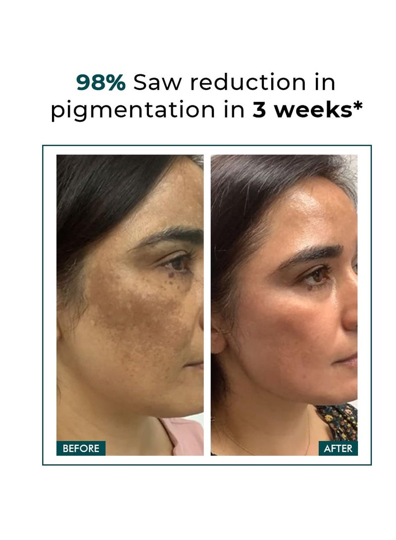 Concious Chemist Conscious Chemist Kojic Acid Face Cream | 20g | Azelaic Acid Cream for Men & Women, Niacinamide & Tranexamic Acid, Anti Pigmentation, Reduce Dark Spots, All Skin Type - Trubiom - Image 2