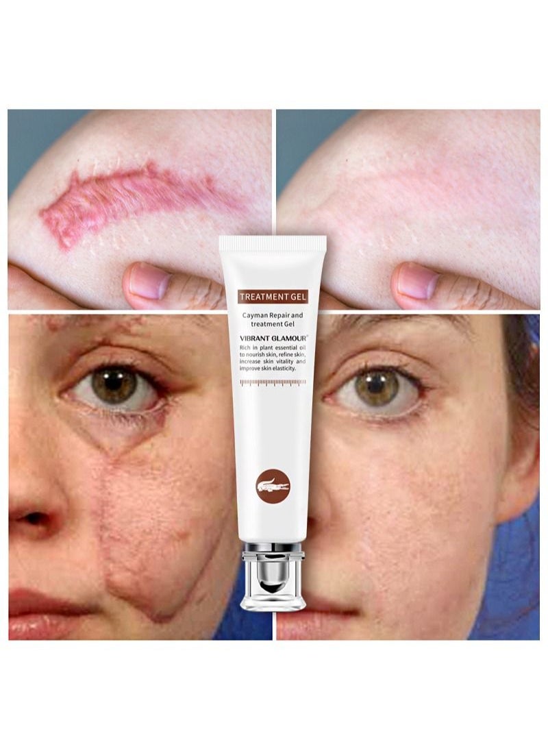Vibrant Glamour - Crocodile Scar Repair Cream, herbal plant extracts repair scars, activate cell vitality, and restore skin to a youthful state from the inside out, 20g - Image 1