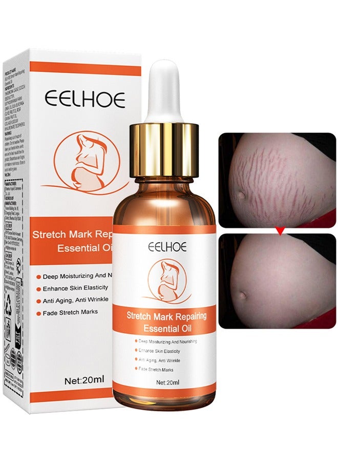 EELHOE Stretch Mark Repairing Essential Oil, Pure Natural Maternity Skin Care Body Oil Scar Repair Removal Stretch Marks Oil 20ML - Image 1