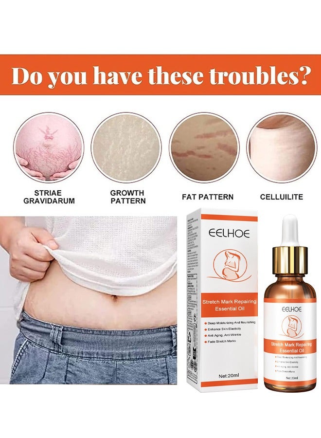 EELHOE Stretch Mark Repairing Essential Oil, Pure Natural Maternity Skin Care Body Oil Scar Repair Removal Stretch Marks Oil 20ML - Image 5