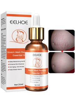 Stretch Mark Repairing Essential Oil, Pure Natural Maternity Skin Care Body Oil Scar Repair Removal Stretch Marks Oil 20ML