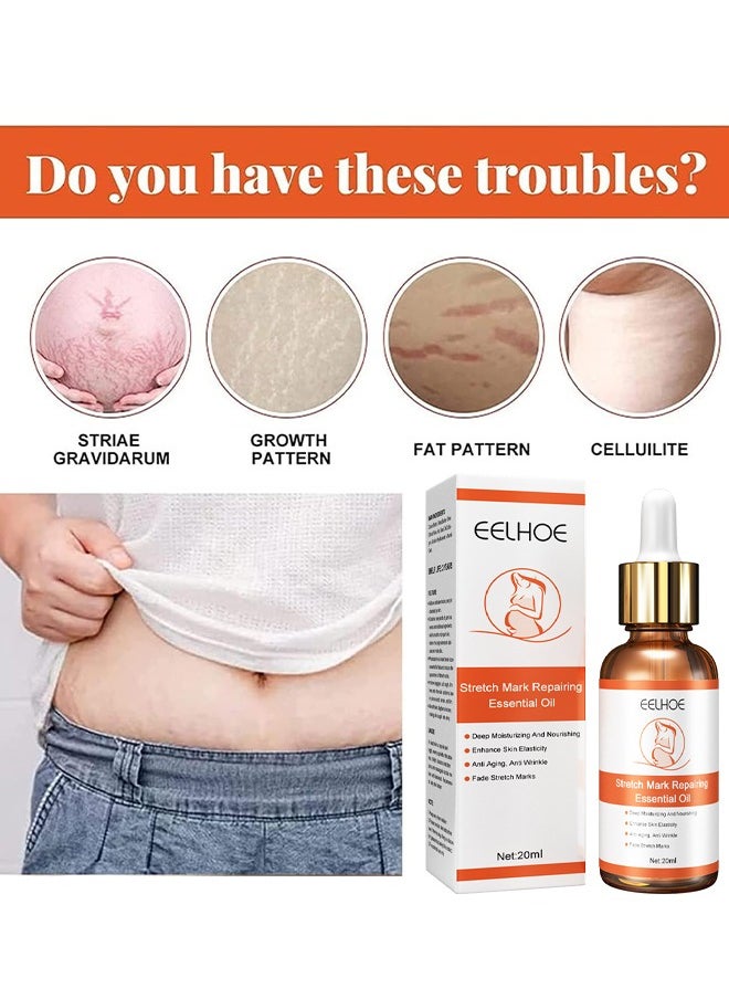 EELHOE - Stretch Mark Repairing Essential Oil, Pure Natural Maternity Skin Care Body Oil Scar Repair Removal Stretch Marks Oil 20ML - Image 1
