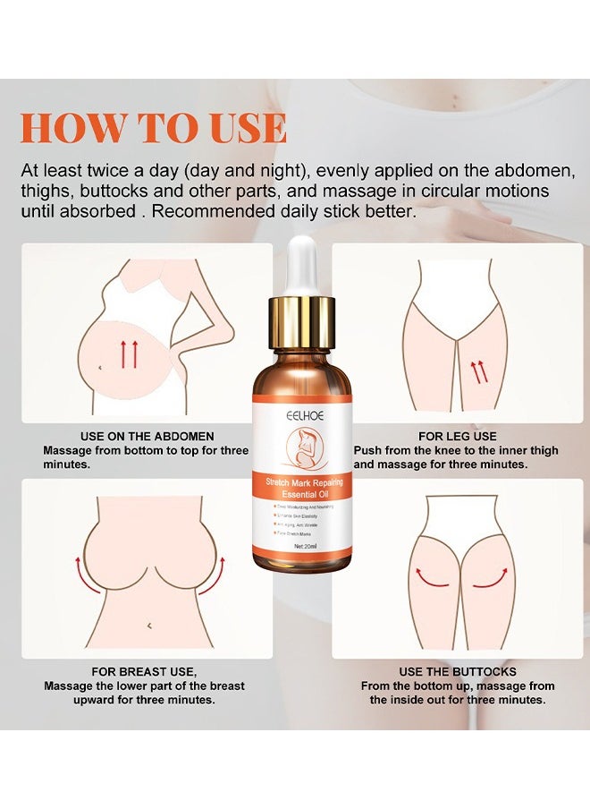 EELHOE - Stretch Mark Repairing Essential Oil, Pure Natural Maternity Skin Care Body Oil Scar Repair Removal Stretch Marks Oil 20ML - Image 1
