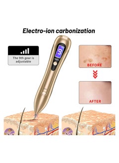 ASIV Laser Mole Removal Pen, Portable Skin Tag Removal Pen with 9 Intensity Levels, 10 Replaceable Fine Needles for Face, Body Warts, Freckles, Mole Spot Treatment and Age Spots  - Image 5