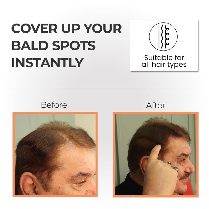 STYLEMAKE Thickener Hair Loss Concealer  Hair Building Fibers 28Gm  Hair Fibers For Thin  Fine Hair  Hair Thickening Fibers For Men  Women Dark Brown 28 Grams - Image 2