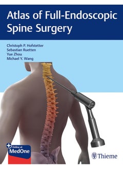 Atlas of Full-Endoscopic Spine Surgery 