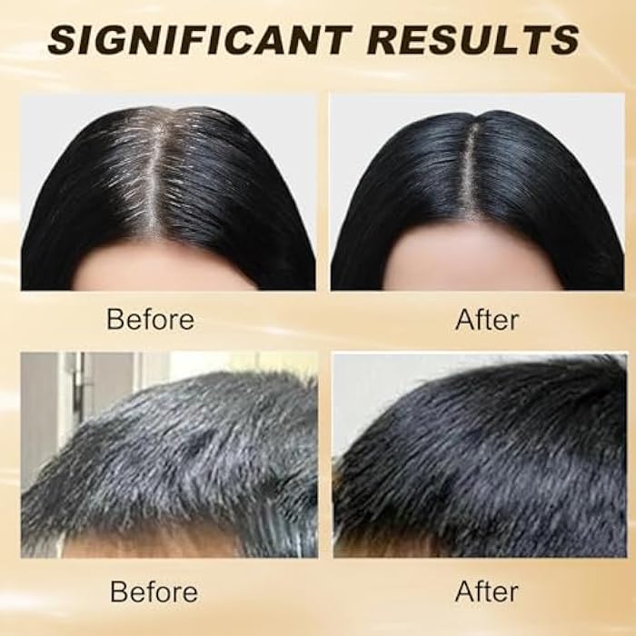 EOIRULA 2PCS Gray Hair Reverse Shampoo Bar, Black Soap for for Hair & Beard Darkening, Deep Clean The Scalp for Unisex Shampoo Soap for Women and Men - Image 4