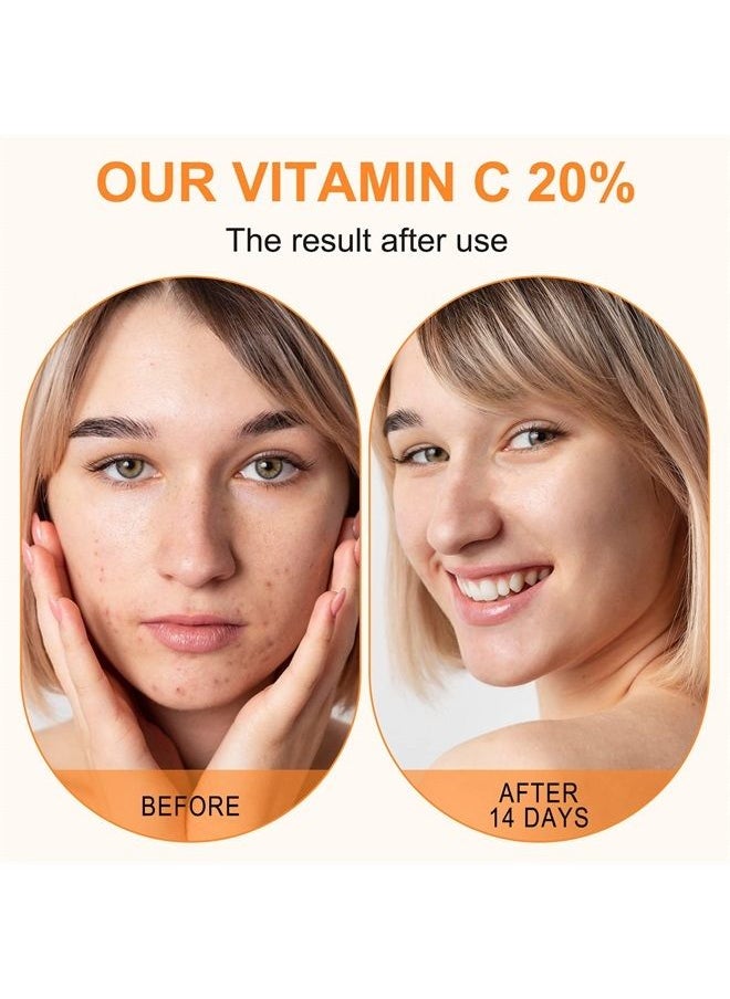 ELBBUB - Premium 20% Vitamin C Serum For Face with Hyaluronic Acid, Retinol & Amino Acids - Boost Skin Collagen,Hydrate & Plump Skin, Anti Aging & Wrinkle Facial Serum 60ml - Image 1
