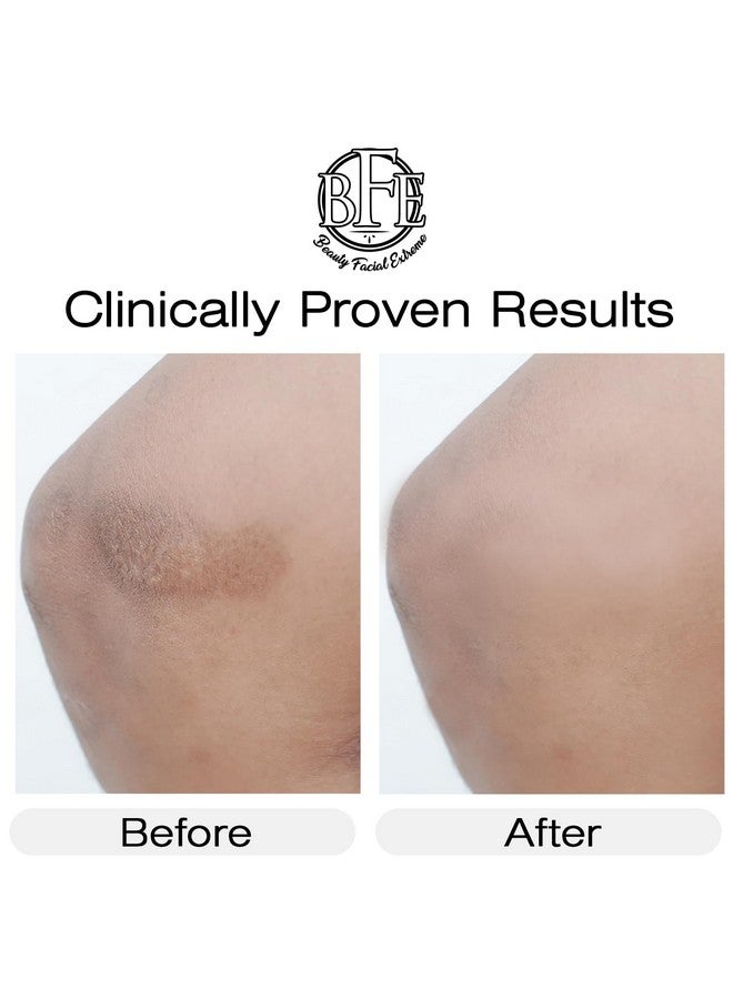 بيوتي فيشال إكستريم كريم فيتامين ك - تركيبة مرطبة لعلاج الكدمات. مصحح للبقع الداكنة، يُخفف من الكدمات، والأوردة العنكبوتية، والشعيرات الدموية المتشققة. يُقلل من الهالات السوداء، والخطوط الدقيقة، والانتفاخات، والتجاعيد تحت العينين. - Image 3