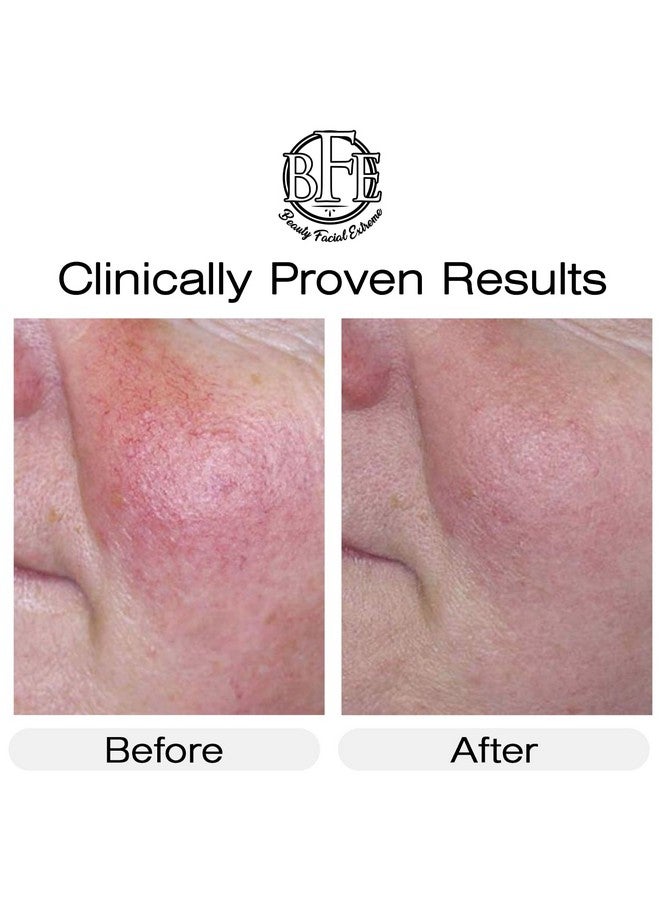 بيوتي فيشال إكستريم كريم فيتامين ك - تركيبة مرطبة لعلاج الكدمات. مصحح للبقع الداكنة، يُخفف من الكدمات، والأوردة العنكبوتية، والشعيرات الدموية المتشققة. يُقلل من الهالات السوداء، والخطوط الدقيقة، والانتفاخات، والتجاعيد تحت العينين. - Image 5