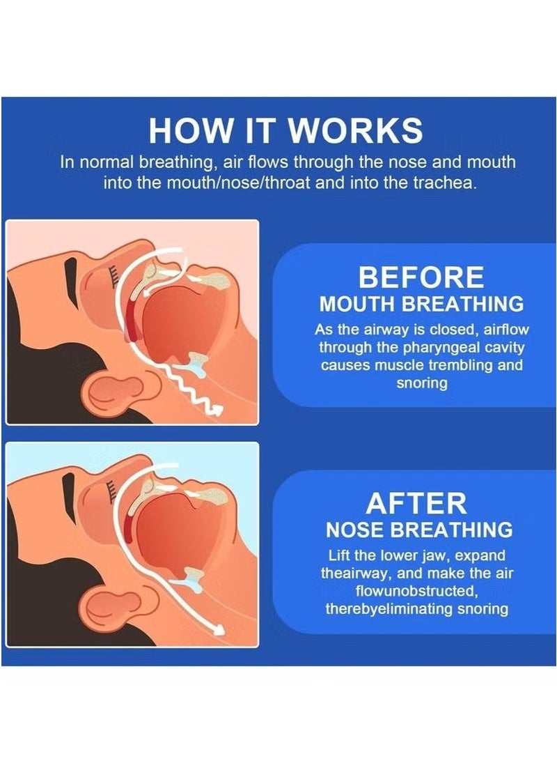 ATRJSZ 1 piece anti-snoring splint, effective snoring stopper for men and women, high-quality mouth splint against snoring, alternative to nose dilators and nose patches, with storage box - Image 2