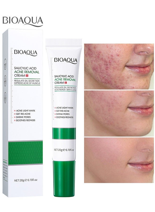 BIOAOUA Salicylic Acid Acne Removal Cream, Acne Treatment Face Cream, Acne Spot Treatment For Face And Acne Dots, Natural Cystic Acne Treatment, Premium Acne Scar Cream And Pimple Remover 20G - Image 1