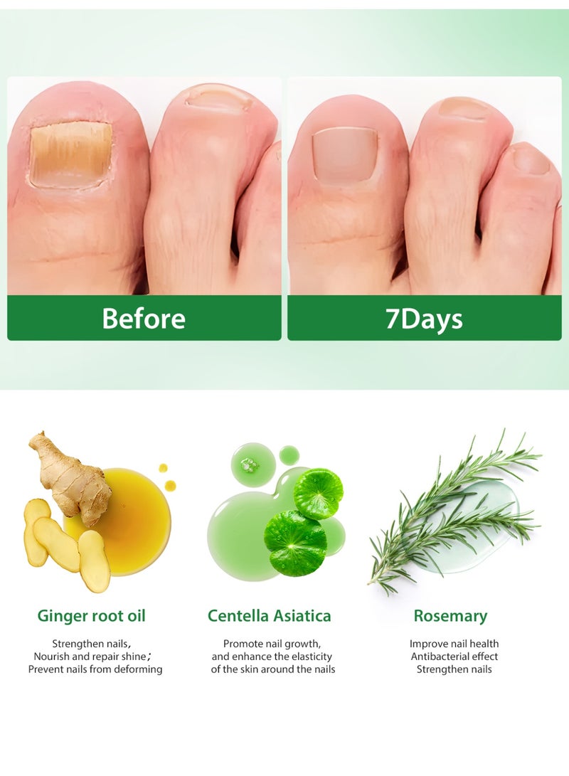 MOOYAM 7 Days Ginger Foot Spray - Odor Control & Callus Care, Natural Ginger Nail Treatment - Refreshing & Nourishing Formula, Plant-Based Care for Feet - Image 4