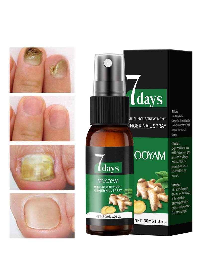 MOOYAM 7 Days Ginger Foot Spray - Odor Control & Callus Care, Natural Ginger Nail Treatment - Refreshing & Nourishing Formula, Plant-Based Care for Feet - Image 1