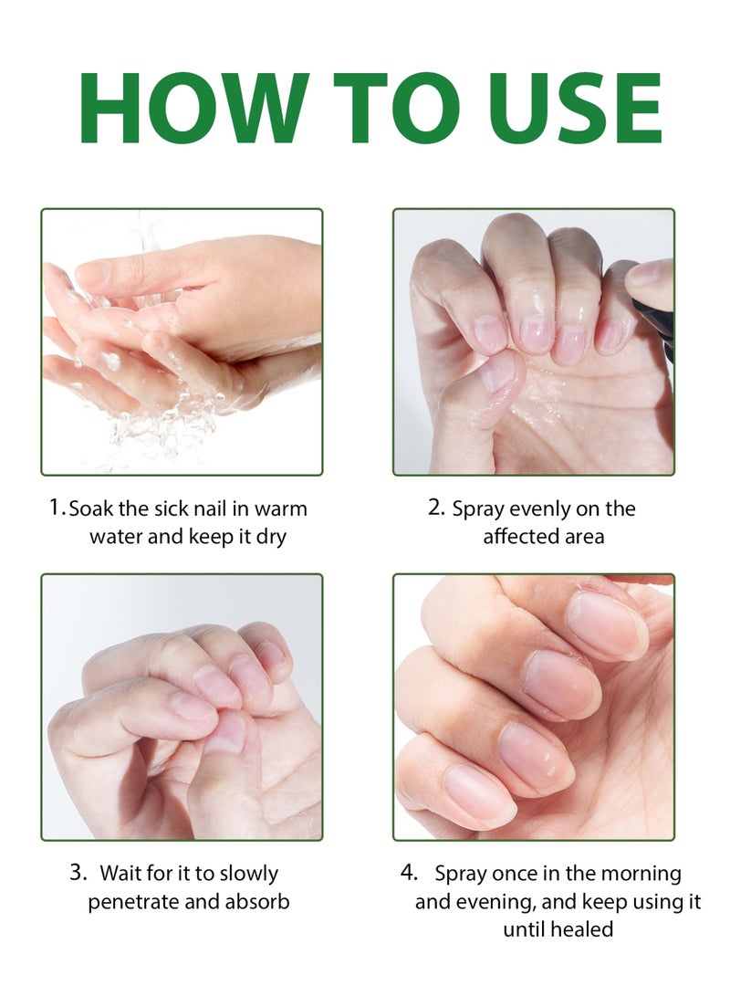 MOOYAM 7 Days Ginger Foot Spray - Odor Control & Callus Care, Natural Ginger Nail Treatment - Refreshing & Nourishing Formula, Plant-Based Care for Feet - Image 5