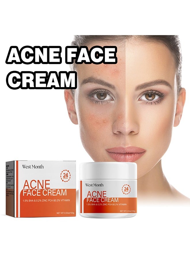 West&Month Acne Face Cream, Acne Spot Treatment for Face & Acne Dots, Natural Cystic Acne Treatment, For All Skin Types, Premium Acne Scar Cream & Pimple Remover 100g  - Image 1