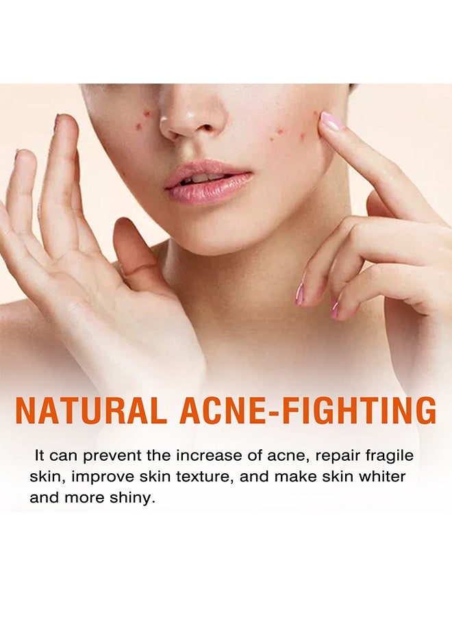 West&Month Acne Face Cream, Acne Spot Treatment for Face & Acne Dots, Natural Cystic Acne Treatment, For All Skin Types, Premium Acne Scar Cream & Pimple Remover 100g  - Image 4