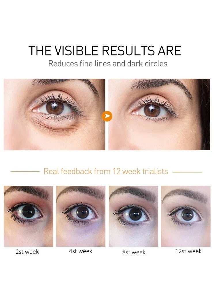 EELHOE كريم عين أكياس الببتيد مع حمض الهيالورونيك لإزالة الدوائر الداكنة والتجاعيد مع جهاز تدليك رولر للعناية بالبشرة والجمال - Image 3