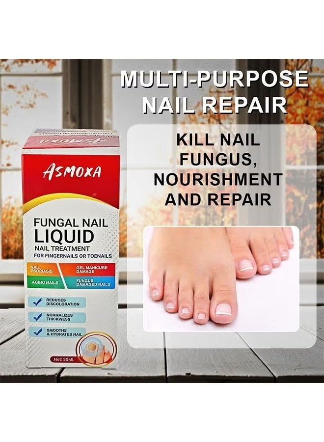 ASMOXA Fungal Nail Liquid 30ml, Nail Treatment for Fingernails and Toenails, Fungal Nail Renewal Anti Fungus Nail Repair Gel, Smooth and Hydrates Nail Reduce Discoloration - Image 5