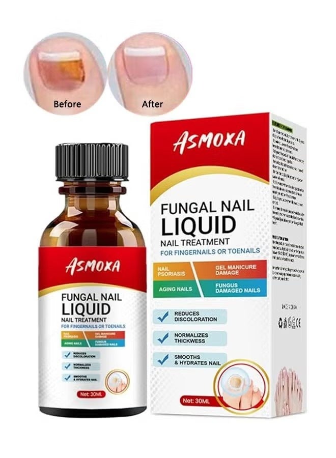 ASMOXA Fungal Nail Liquid 30ml, Nail Treatment for Fingernails and Toenails, Fungal Nail Renewal Anti Fungus Nail Repair Gel, Smooth and Hydrates Nail Reduce Discoloration - Image 1