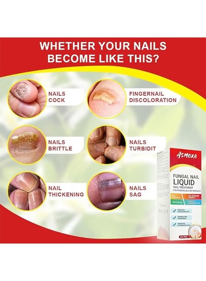 ASMOXA Fungal Nail Liquid 30ml, Nail Treatment for Fingernails and Toenails, Fungal Nail Renewal Anti Fungus Nail Repair Gel, Smooth and Hydrates Nail Reduce Discoloration - Image 2