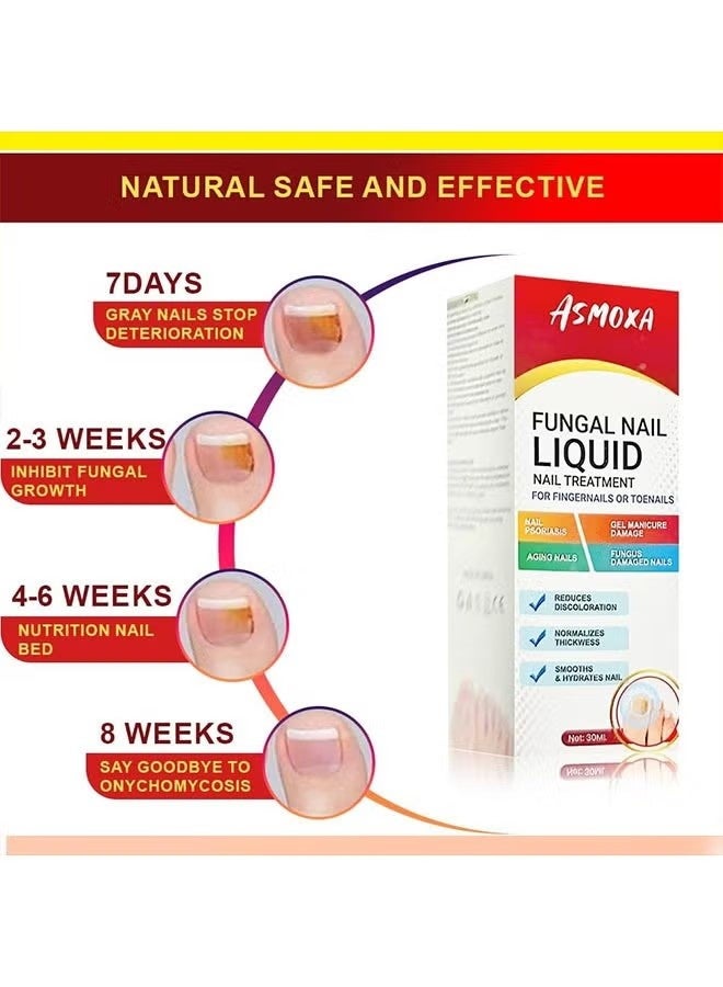 ASMOXA Fungal Nail Liquid 30ml, Nail Treatment for Fingernails and Toenails, Fungal Nail Renewal Anti Fungus Nail Repair Gel, Smooth and Hydrates Nail Reduce Discoloration - Image 4