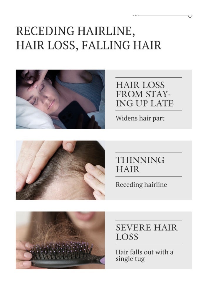 Kormesic 2-PACK 5% Minoxidil Hair Growth Serum 30ml*2 - Image 3