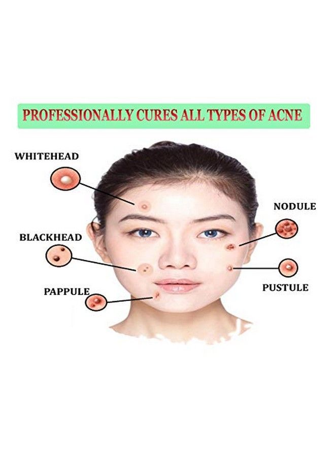 Amueroz Anti Acne Serum Pack Of Two Acne Clearing Facial Serum ; Antiscar Collagen Serum - Image 3