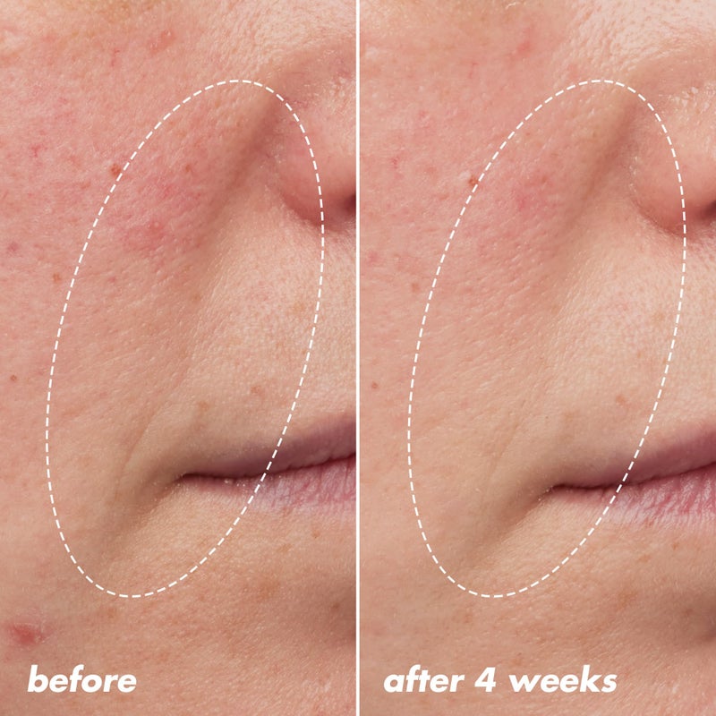 elf e.l.f. SKIN Youth Boosting Blue-ty Sleep Night Oil, Gentle Overnight Face Oil, Treats Fine Lines & Uneven Texture, Lightweight, Vegan & Cruelty-Free - Image 5