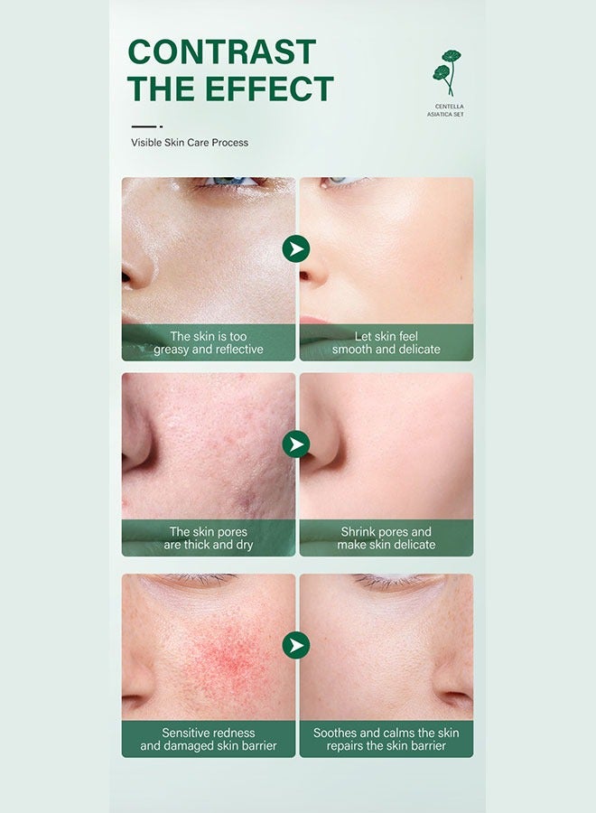 ايريف كريم سنتيلا، غني بـ VCCream، كريم مرطب، كريمات سنتيلا المهدئة، مضاد للشيخوخة، ترطيب - Image 5