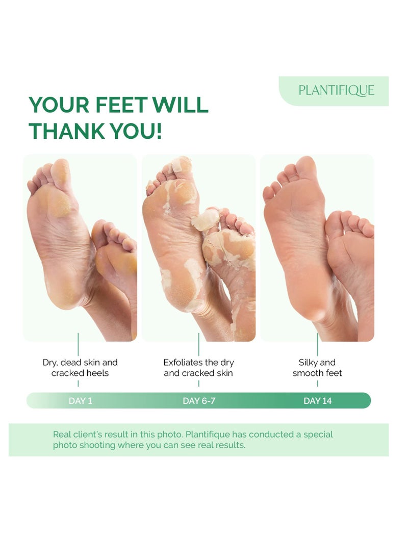 Plantifique - PLANTIFIQUE Foot Peeling Mask (2 Pairs) - Peeling Foot Mask Dermatologically Tested Repairs Heels & Removes Dry Dead Skin for Baby Soft Feet - Exfoliating Foot Peel Mask for Dry Cracked Feet (Peach) - Image 1